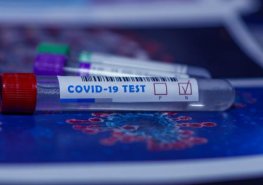 Odběrové místo v Pardubické nemocnici rozšiřuje provozní dobu, mění se i místa odběrů