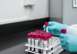 Na odběry biologického materiálu nově i do areálu Orlickoústecké nemocnice