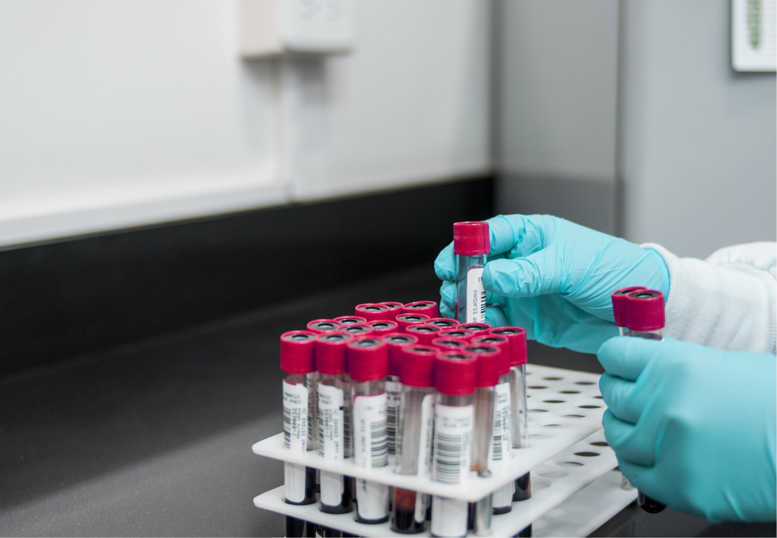 Na odběry biologického materiálu nově i do areálu Orlickoústecké nemocnice